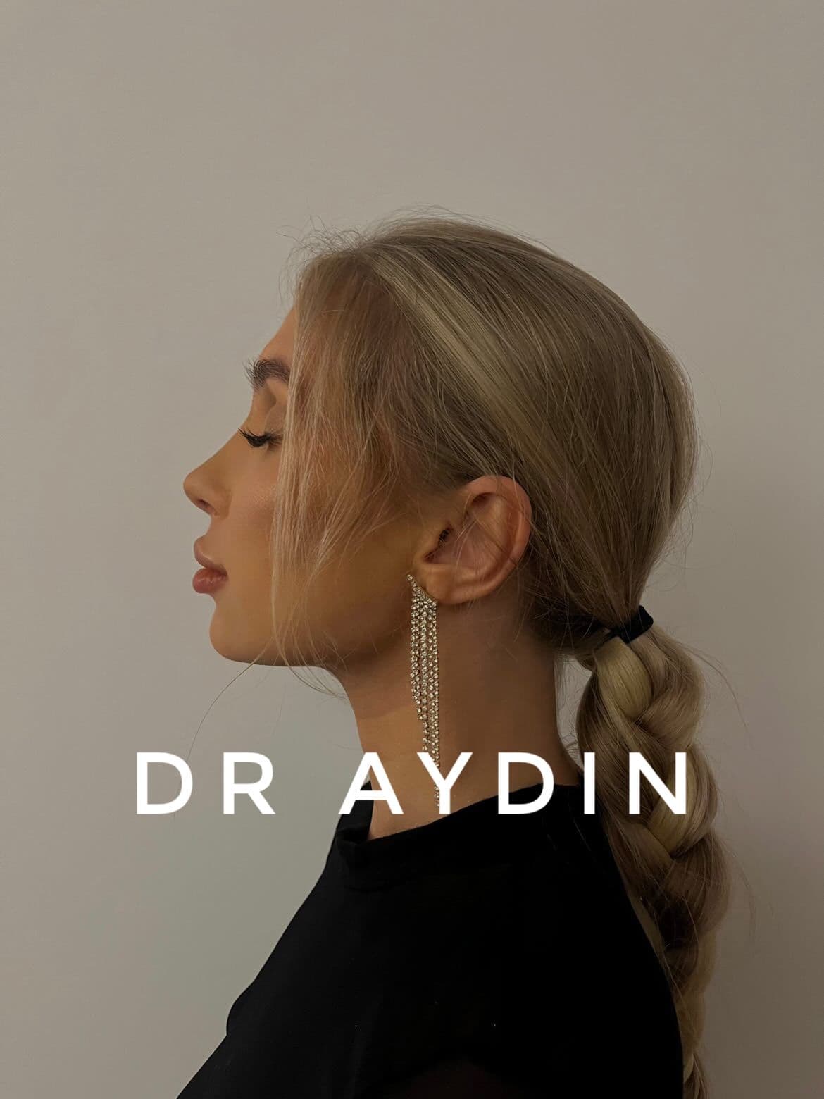 Rhinoplasty clinic Instagram photo — Op. Dr. Ahmet Halit Aydın